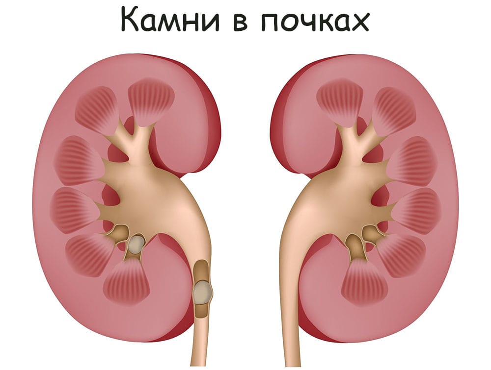 Кракен короткая ссылка